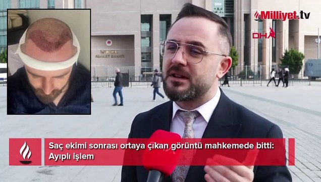 Saç ekimi sonrası ortaya çıkan görüntü mahkemede bitti: Ayıplı işlem
