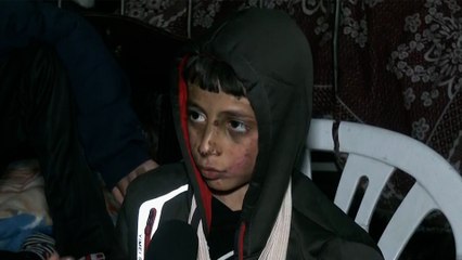 قصص إنسانية لأطفال مصابين بالقصف الإسرائيلي على غزة