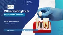 Unlocking the Mystery: 19 Surprising Facts About Dental Implants