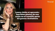 Loana violée et agressée : horribles photos de son corps nu et tuméfié après les graves révélations