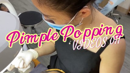 Satisfying Pimple Popping Videos 011