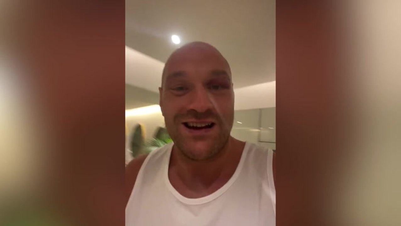 Tyson Fury shares Oleksandr Usyk fight update as boxer shows off freak eye cut