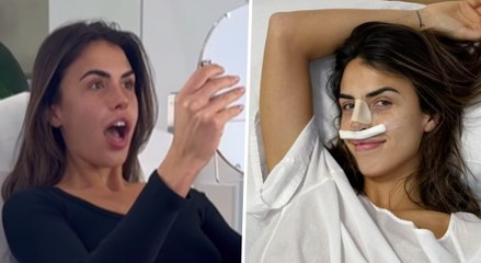 Sofía Suescun enseña su nueva nariz tras someterse a una rinoplastia: "¡Me encanta!"