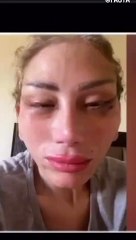 تشوه وجه ريهام سعيد بعد خضوعها للتجميل عند دكتور تجميل مشهور