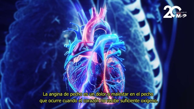 ¿Qué es la angina de pecho y cómo se manifiesta? - #ExclusivoMSP