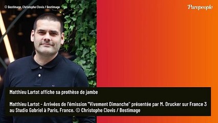 PHOTOS Matthieu Lartot affiche sa prothèse de jambe pour partager un message fort
