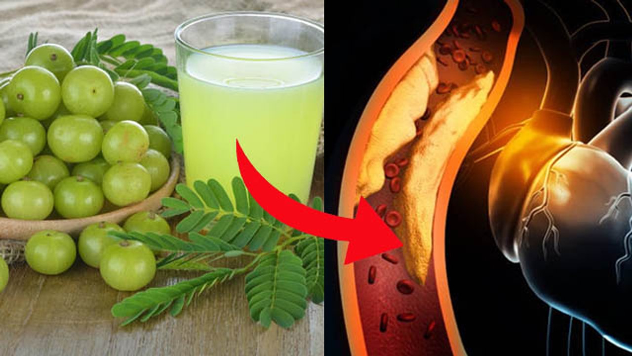 हाई कोलेस्ट्रॉल कम करने के लिए ऐसे पिएं आंवले का जूस Is Amla Juice