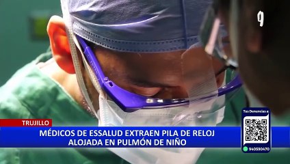 La Libertad: Médicos salvan la vida a niño de 4 años con pila alojada en un pulmón