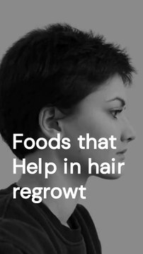 Foods that help in hair regrowth || Foods for hair growth