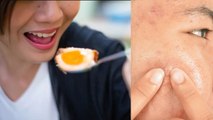 Egg Khane Se Pimple Hota Hai Kya | अंडा खाने से पिंपल होता है क्या | Boldsky