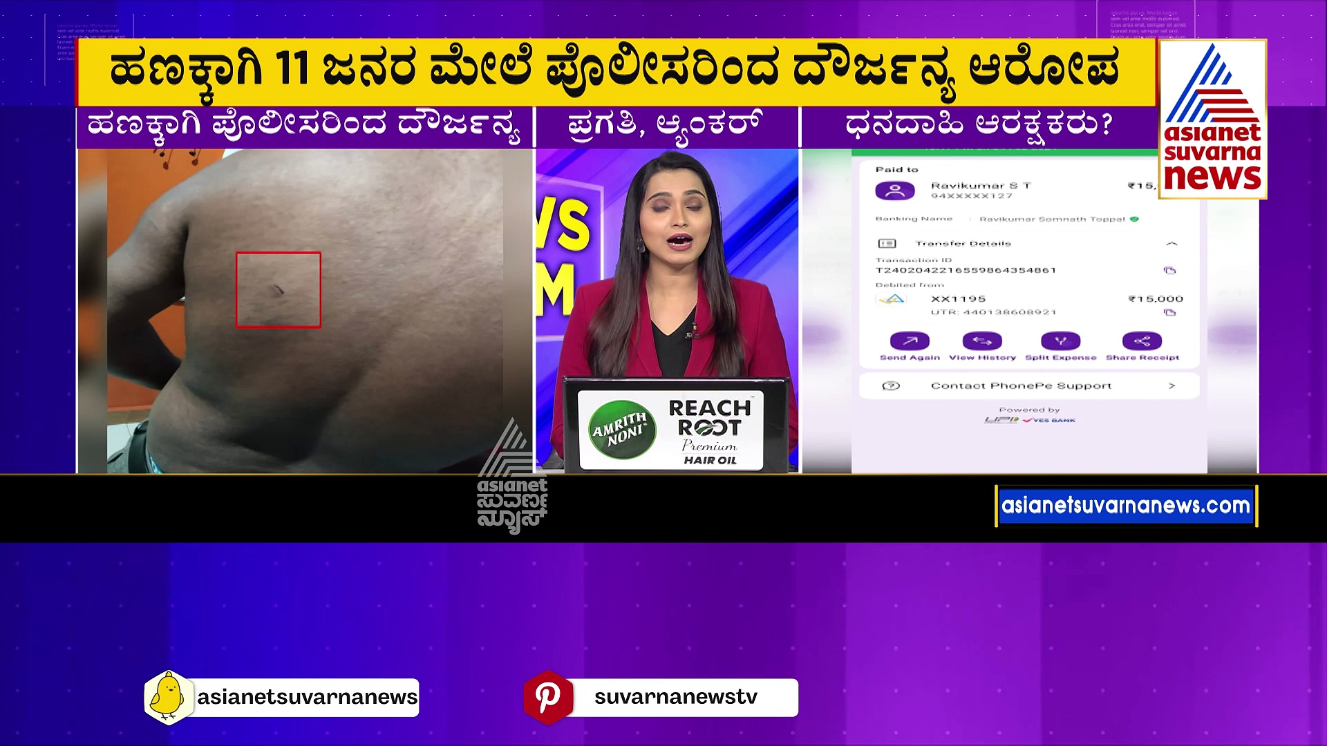 Hubli: 11 ಜನರ ಮೇಲೆ ಪೊಲೀಸರಿಂದ ದೌರ್ಜನ್ಯ ಆರೋಪ: ಹಣಕ್ಕಾಗಿ ಕಾಯುವ ರಕ್ಷಕರೇ ರೌಡಿಗಳಂತೆ ವರ್ತಿಸಿದ್ರಾ ? 
