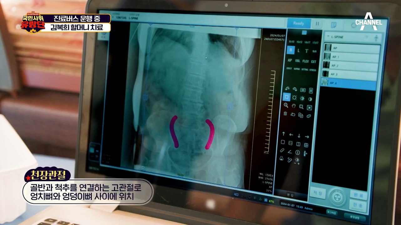 모시 능력자도 피하지 못한 허리 통증! 국민사위의 허리 치료