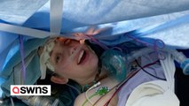 Woman sings and recites 50 US states as doctors perform brain surgery to remove tumour
