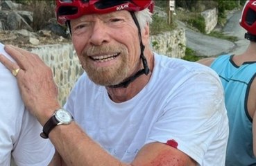 Sir Richard Branson acaba ensangrentado y magullado tras un accidente en bicicleta