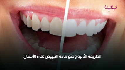 تبييض الأسنان في المنزل بأسهل الطرق
