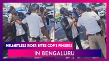 Bengaluru: Helmetless Rider Bites Cop’s Fingers For Taking His Picture; Arrested