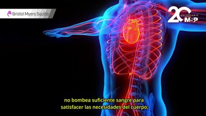 ¿Cómo funciona la cardiomiopatía?- #EspecialMSP