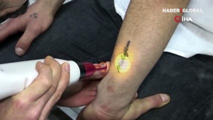 Adana'da ayrılan sevgililerin dövme sildirme telaşı: "Hiçbir umut kalmayınca..."