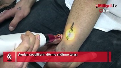 Aşk bitti, dövme silindi: Gitmeyecek dediğim insan gitti