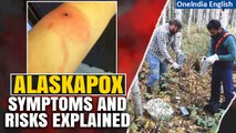 Alaskapox: Unraveling the Details of Alaska's Unusual Spreading Virus | Oneindia News
