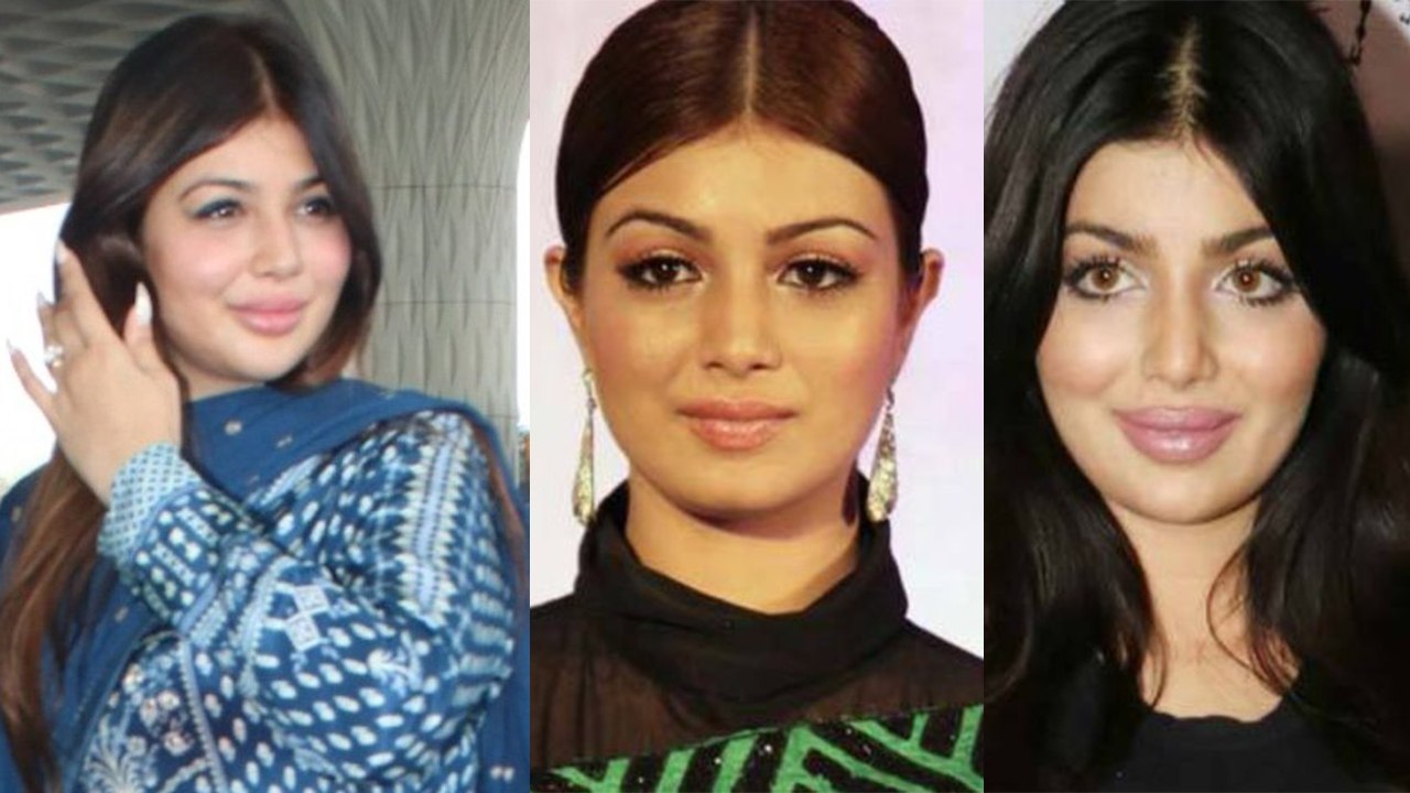 Ayesha Takia की plastic surgery पर सवाल उठाने व...