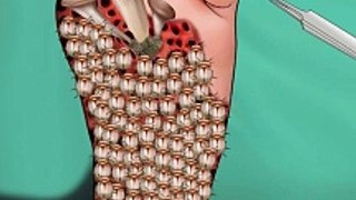 ASMR Remove Ticks from foot Animation - care animation -#youtubeshorts #shorts #short #asmranimation