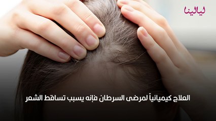 تساقط الشعر الشديد