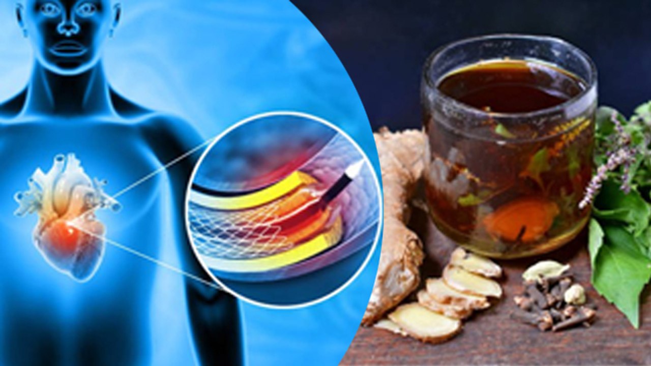 हाई कोलेस्ट्रॉल में तुलसी और अदरक खाने से क्या होता है|High Cholesterol Me Tulsi Adrak Khana Chahiye