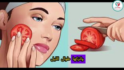 كيفية إزالة الرؤوس السوداء بشكل طبيعي