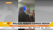 Policía pierde varios dedos tras ser atacado con un machete | Cotorreando la Noticia