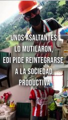 Tras ser mutilado por unos asaltantes, "Edi" busca reintegrarse a la vida productiva dentro de la sociedad #TuNotiReel