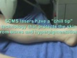 Laser Hair Removal Treatment Legs