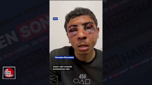 İsrail askerlerinin işkence ettiği Filistinli genç yaşadıklarını anlattı