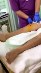 独家｜2华男假买猫 真打抢 猫舍老板被砍伤 缝36针  约万令吉名种猫也被劫