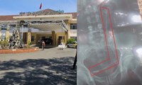 Bệnh viện Lâm Đồng trả nhầm phim chụp X-quang, mổ nhầm bệnh nhân