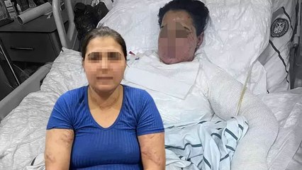 Eşinin ve kayınbiraderinin sıcak ütü basıp, kolonyayla yakmaya çalıştığı Yazgül: Beni öldürecekler
