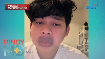 Pangarap na pouty at plumped lips, nauwi sa palpak na resulta?! | Pinoy MD