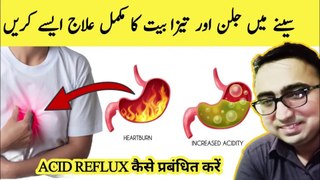 How Acid Reflux Should Be Treated ? 3 Steps To Treat Acid Reflux & HeartBurn #acidreflux