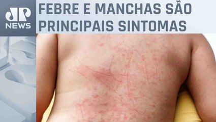 Entenda ciclo de vida do mosquito da dengue e como prevenir multiplicação do inseto