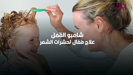 شامبو القمل علاج فعَال لحشرات الشعر