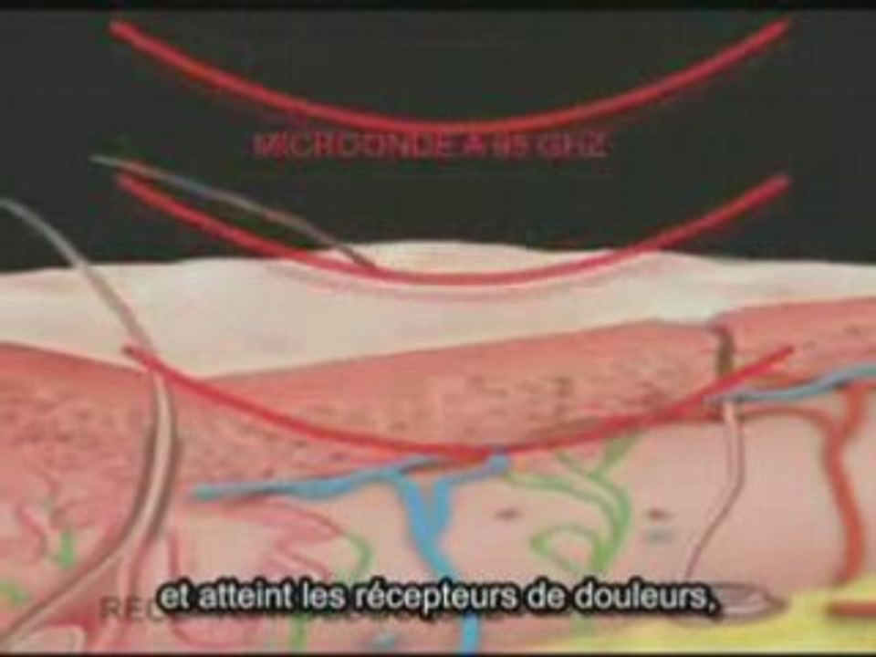 Laser Tactique à Haute Energie (THEL) 2 sur 2