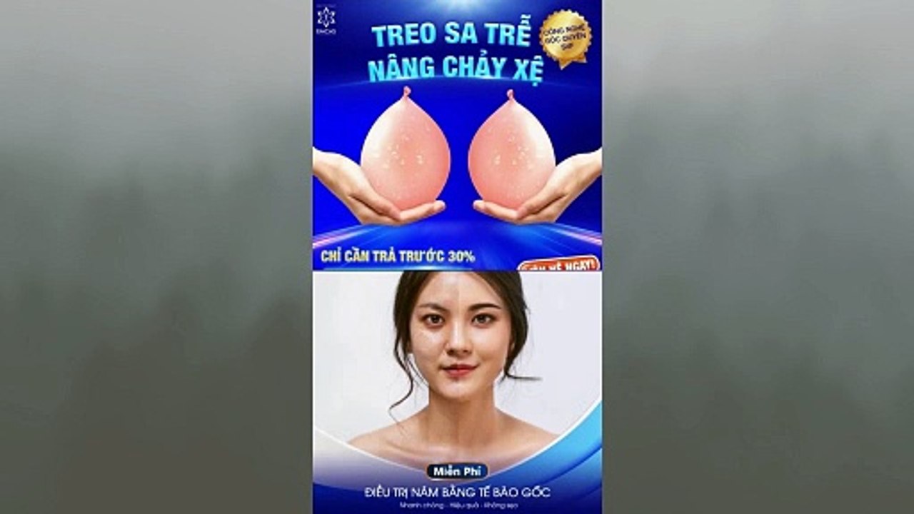 Review Thẩm Mỹ Viện EMCAS Chết Người Tin Đồn Và Thực Tế