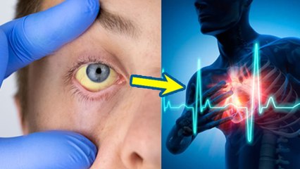 क्या शरीर में खून की कमी से हार्ट की बीमारी हो सकती है | Can Iron Deficiency Cause Heart Problems
