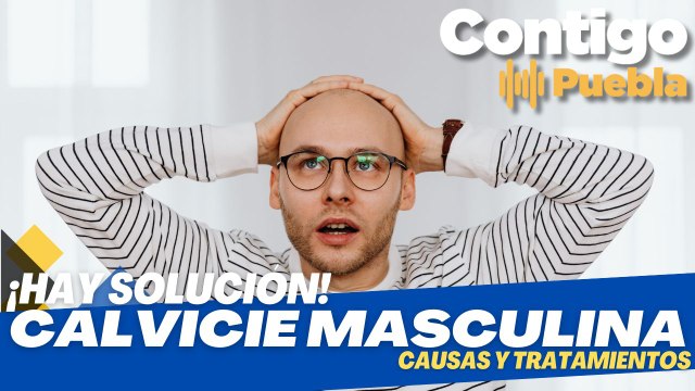 Desvelando las causas y tratamientos de la #calvicie masculina
