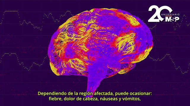 Día Mundial de la Encefalitis: ¿Qué es y cómo funciona?