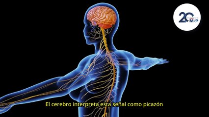 ¿Qué es el prurito y cómo funciona la sensación de picor en la piel?- #ExclusivoMSP