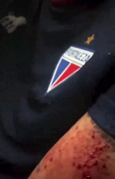 Futbolistas del Fortaleza de Brasil heridos en ataque de fanáticos a su autobús