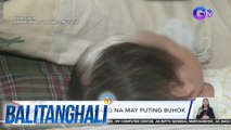 Sanggol, isinilang na may puting buhok | BT