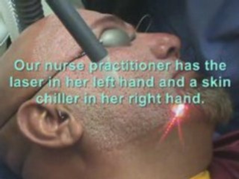 Laser Acne Scar Removal Treatment - Hispanic Patient