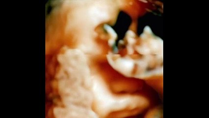 De humani corporis fabrica (2022) - Bande annonce